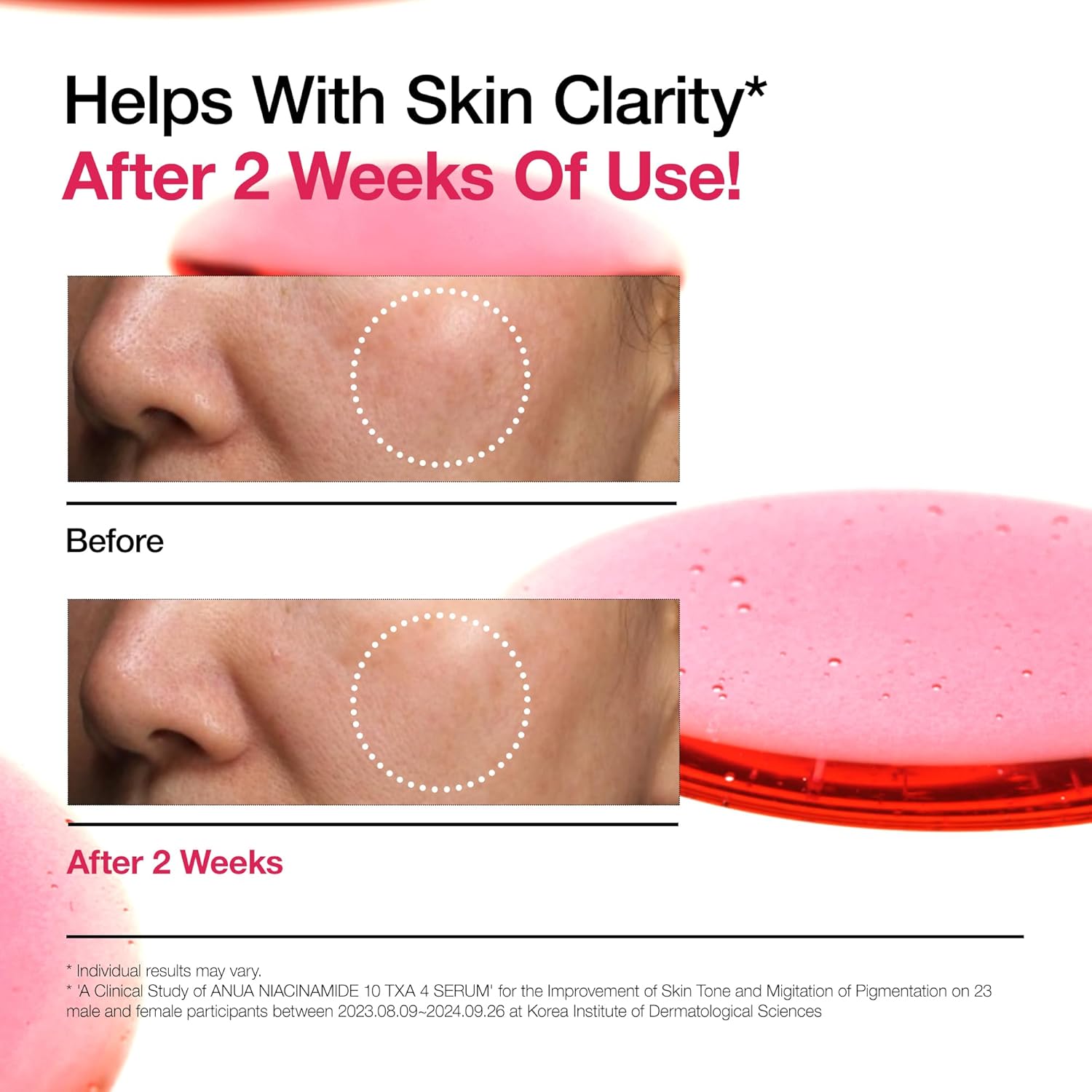 Anua Niacinamide 10% + TXA 4% Serum