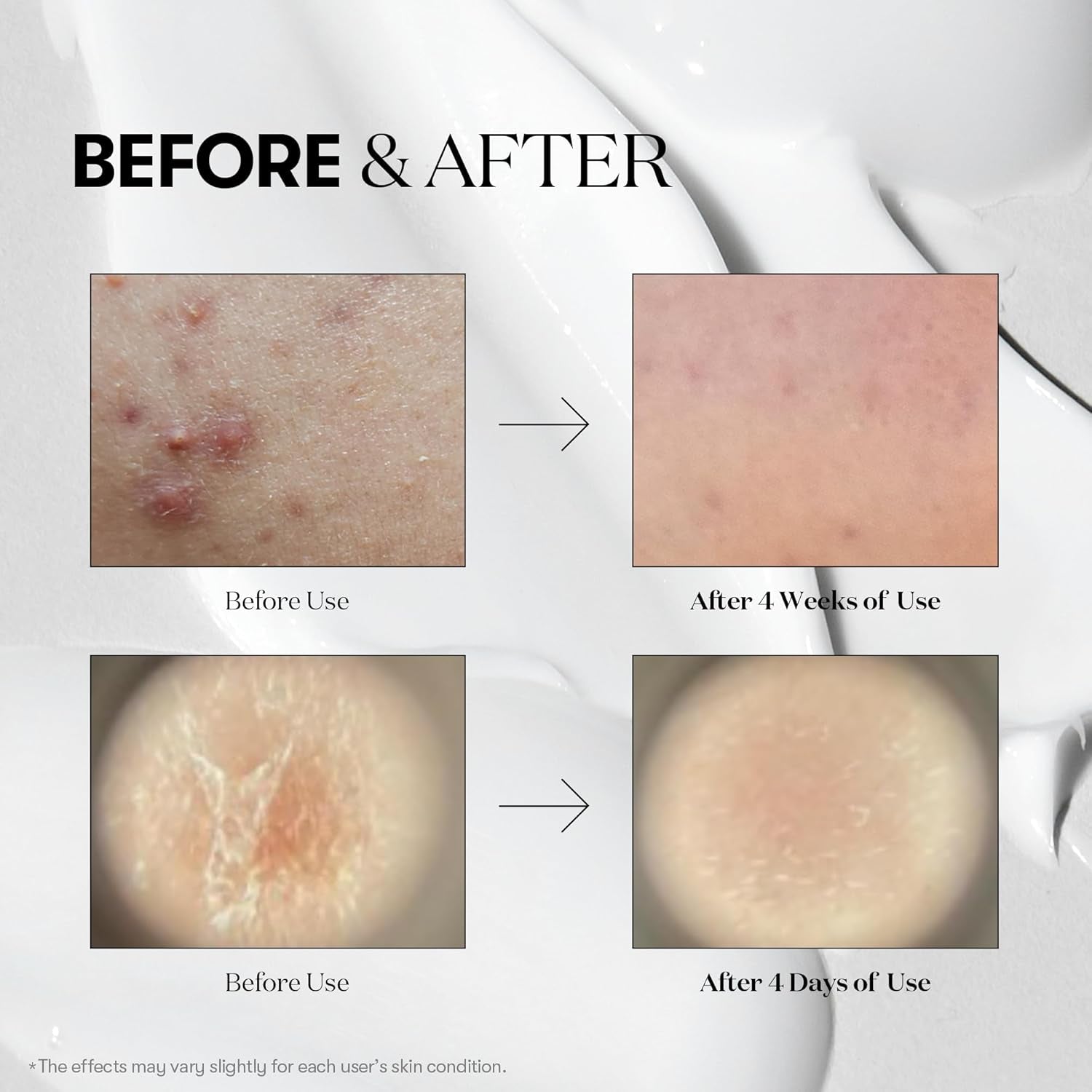 VT Reedle Shot 300 Essence