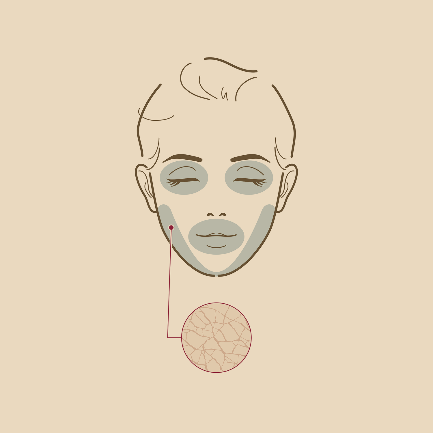 Dry Skin