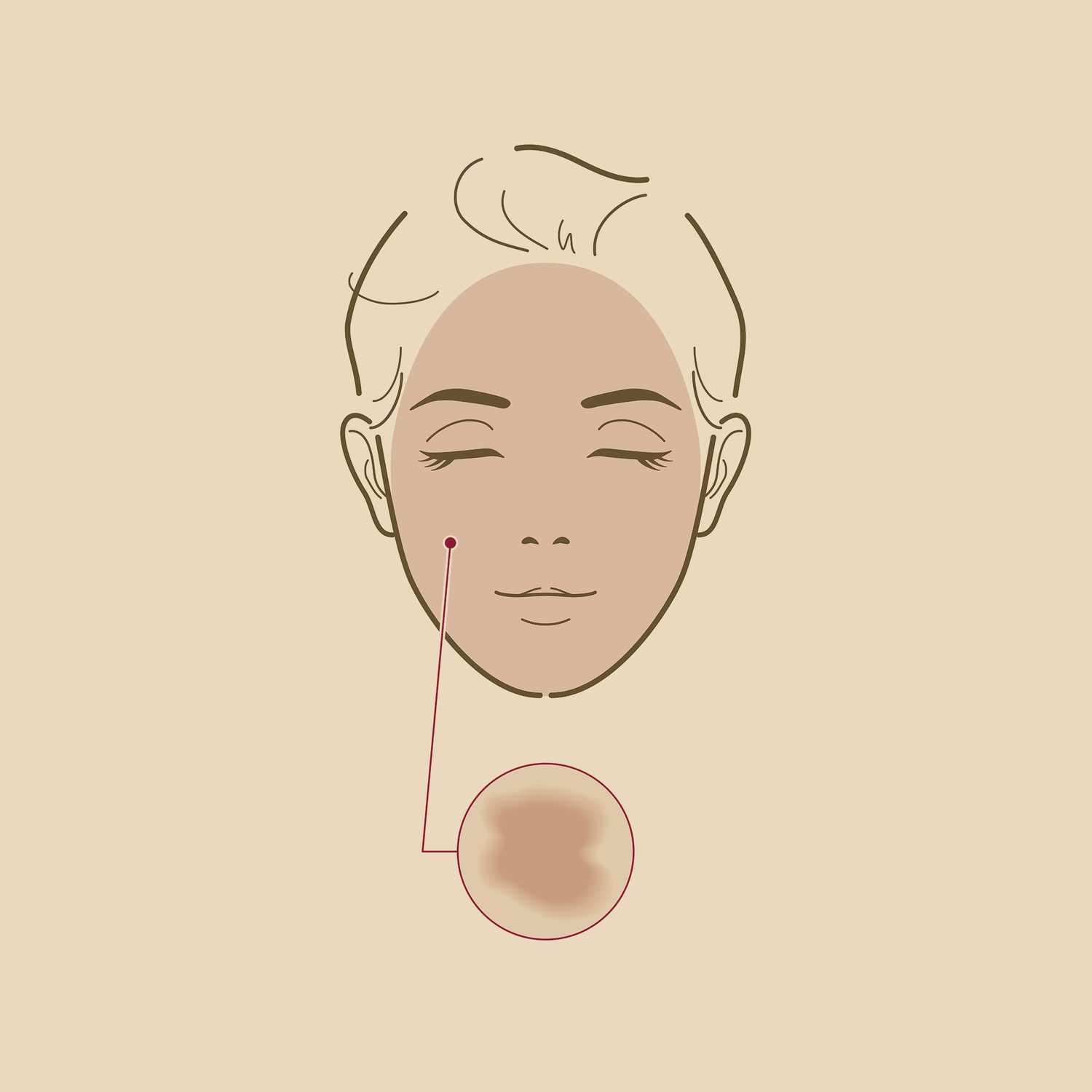 Sensitive Skin
